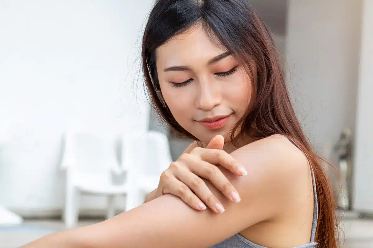 Understanding and Treating Keloids Surgery to Natural Remedies