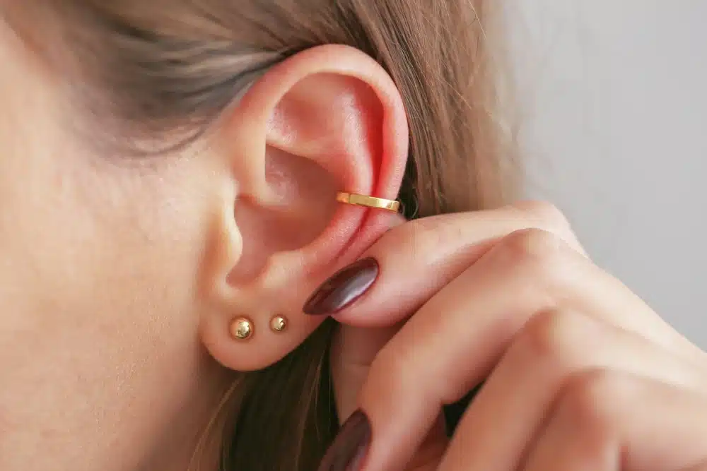 Close-up of ear with multiple piercings showing a possible piercing bump or keloid for skin comparison.