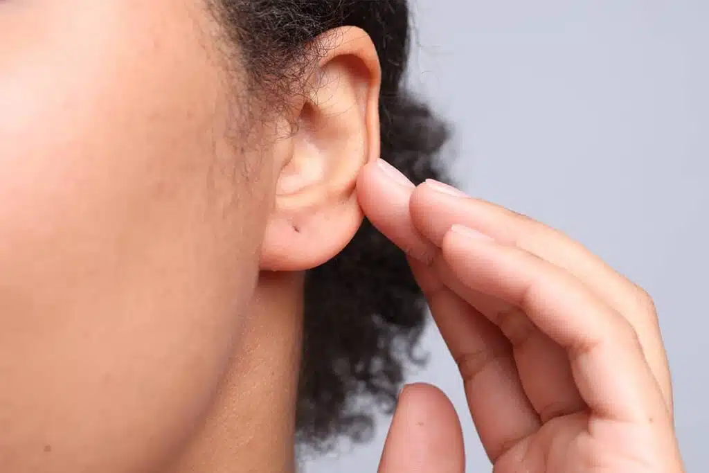 A close-up side view of a person’s earlobe showing a small, healed piercing mark being examined by a hand.